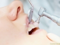 Centrul Medical Dr. Bold ( implanturi dentare timisoara - paradontologie timisoara ) 