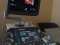 Clinica 1st Medical - Imagistica-Sonoelastometrie ( elastografie timisoara - ecografie timisoara ) 