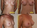 Dr. Serban Porumb ( operatii estetice oradea - chirurgie estetica oradea ) 