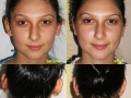 Estetis Clinic - Chirurgie Estetica Dr. Serban Porumb ( marire sani oradea - ridicare sani oradea ) 