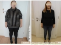 Servicii de tratament varice, hernii, tiroide, hemoroizi, arteriopatie si abdominoplastie, Cluj-Napoca ( chirurgie sani cluj - tratament obezitate cluj ) 
