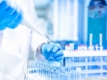 Laboratoare de analize medicale, medicina de laborator: Timisoara, Arad, Bistrita, Brasov, Bucuresti, Cluj-Napoca, Constanta, Deva, Iasi, Oradea, Tirgu Mures ( laborator analize medicale brasov - laborator analize medicale cluj-napoca ) 