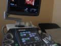  ( ecografie vaginala timisoara - pap test timisoara ) 