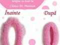  ( consultatii obstetrica-ginecologie timisoara - supraveghere evolutie sarcina timisoara ) 