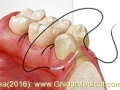 Cabinet Medicina Dentara Dr. Dan Ioan Blebea ( implantologie orala timisoara - chirurgie dento alveolara timisoara ) 