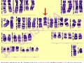  ( diagnostic genetic timisoara - test paternitate timisoara ) 