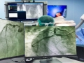 CARDIO ROCORDIS ( cardiologie Timisoara - electrofiziologie adulti ) 